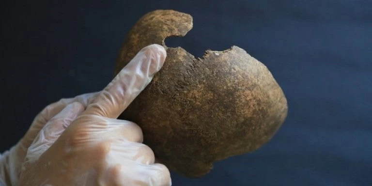 Οταν οι άλλοι ήταν στα δέντρα, οι Αρχαίοι Έλληνες έκαναν νευροχειρουργικές επεμβάσεις (βίντεο)